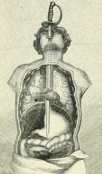 Giving bad ideas to medical science since 1777.